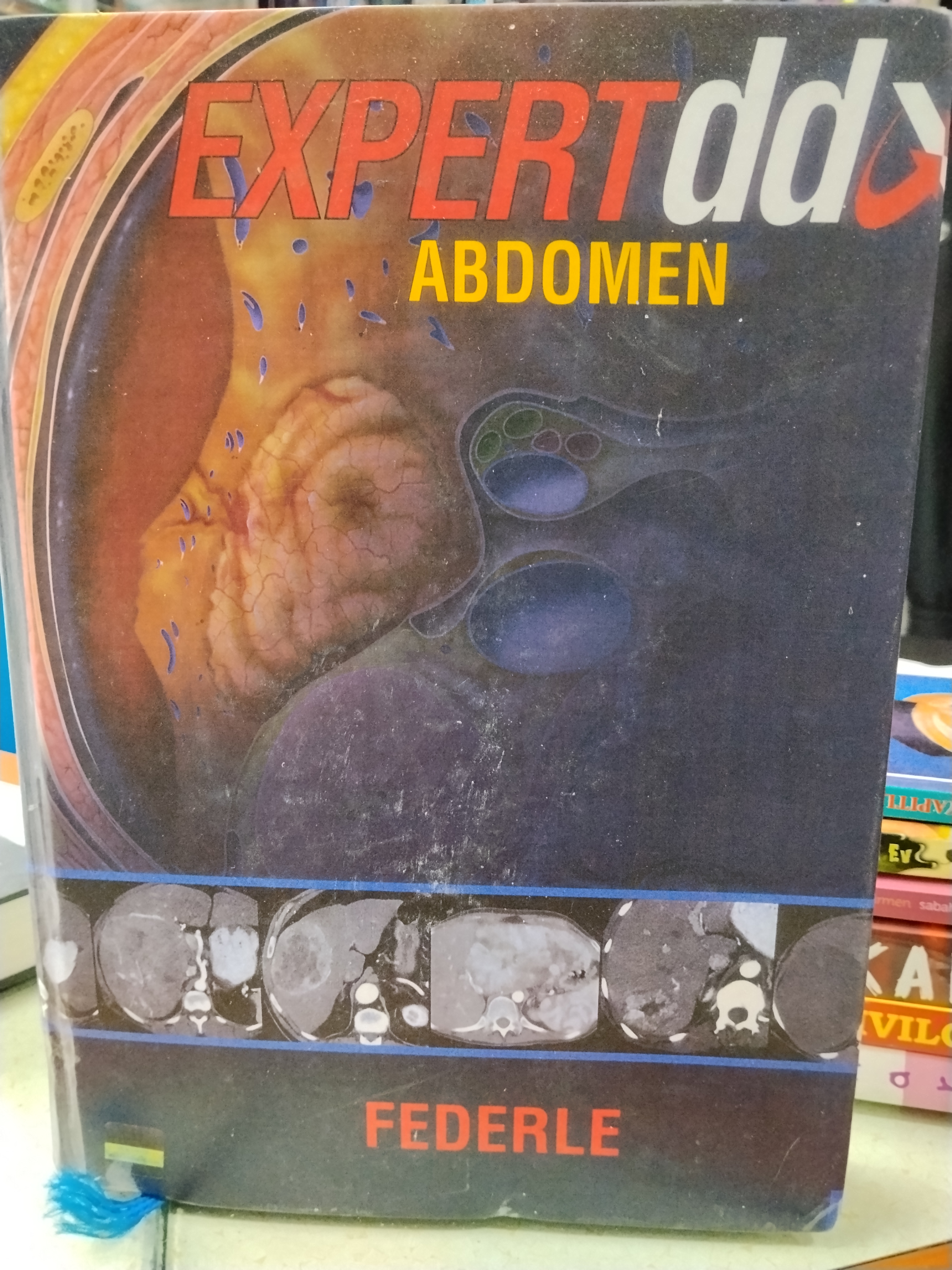 Expertize abdomen